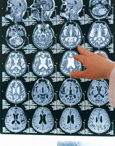 a person looking at an X-ray of a brain