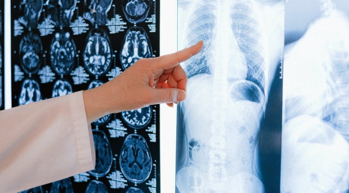a doctor pointing at an x-ray