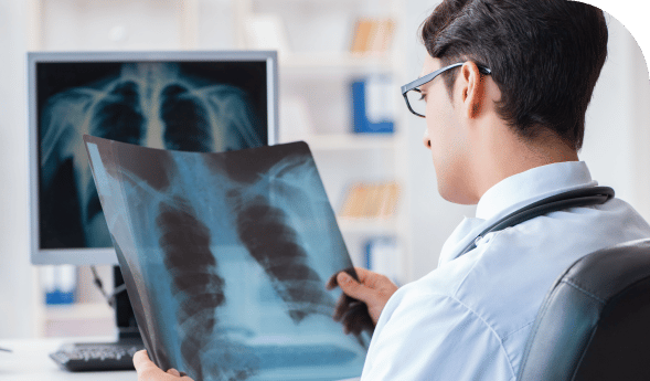 doctor viewing patient chest x-ray