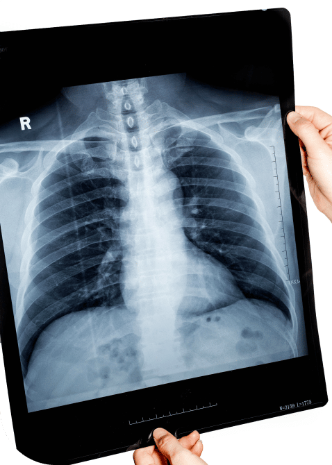 chest x-ray