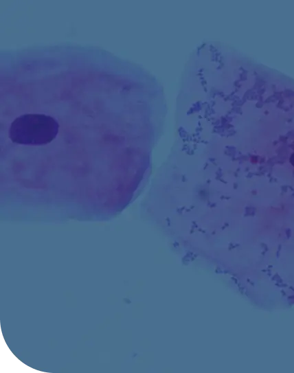 organisms viewed under a microscope