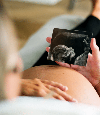 a woman looking at her baby ultrasound picture