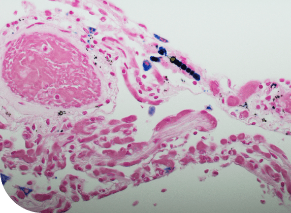 organism under microscope