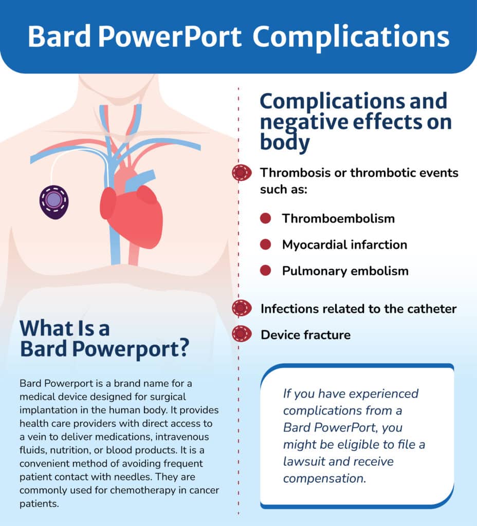 Infographic of complications associated with Bard PowerPort.