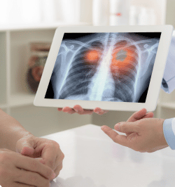Doctor showing a chest X-ray to a patient