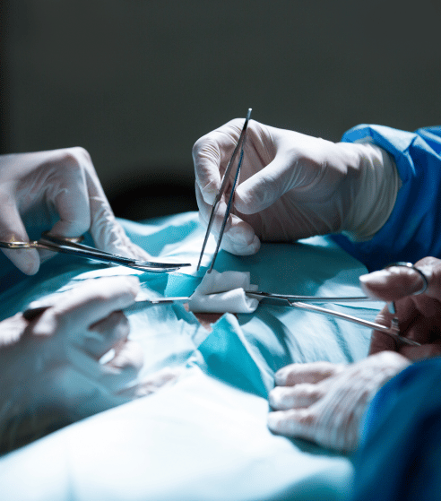 Doctors Performing Mesothelioma Surgery on Patient