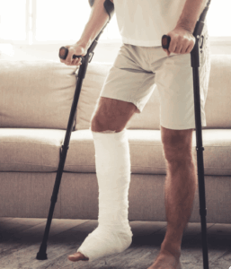 Person with a cast on a leg