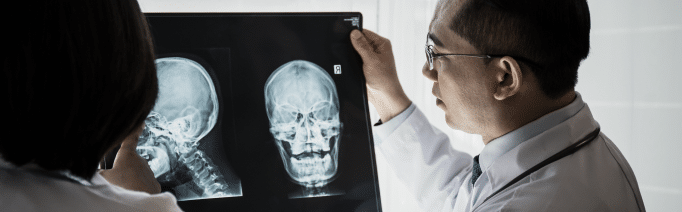 Doctors looking at a head X-ray