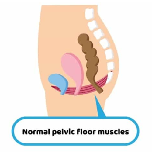 Diagram showing normal pelvic floor muscle structure and support