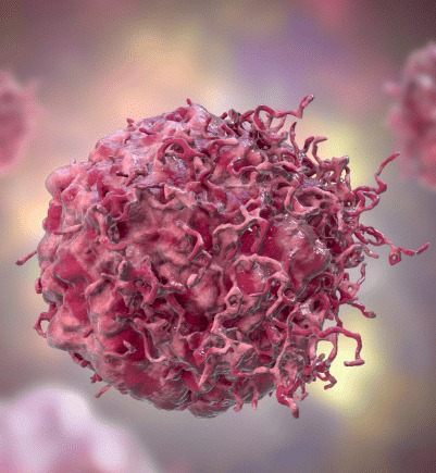 Mesothelioma Cancer Cell From Asbestos Exposure