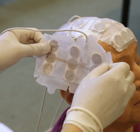 Patient with electrodes beings attached to their head