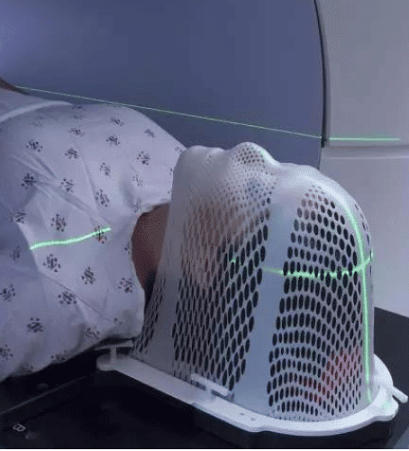 Female patient during Brachytherapy