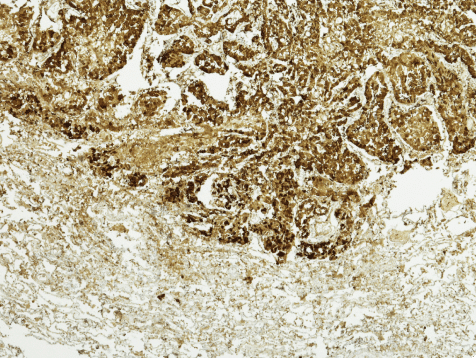 Mesothelial membrane under microscope