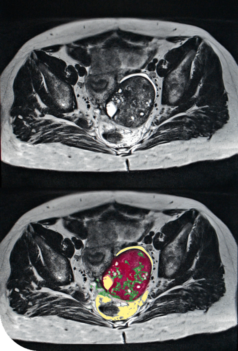 MRI image