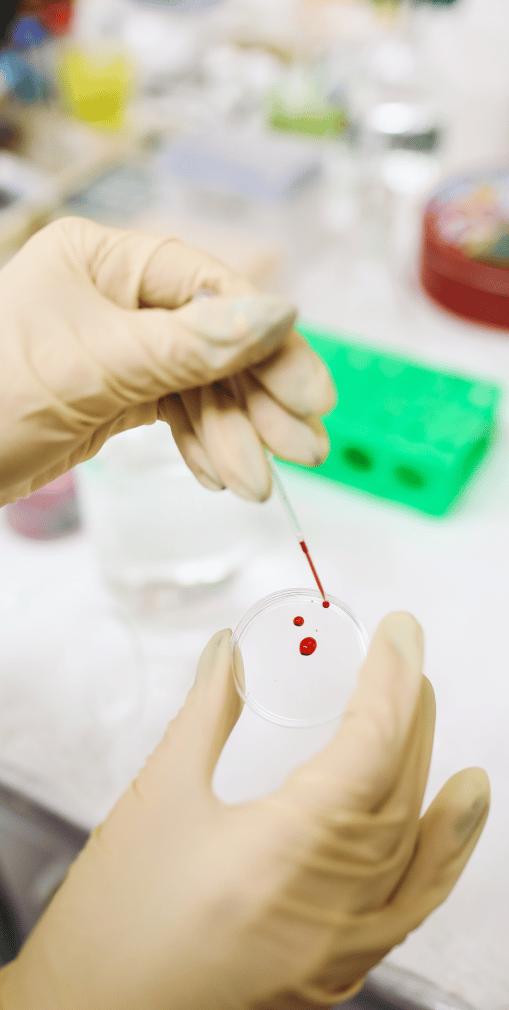 Doctor testing blood on a Petri dish