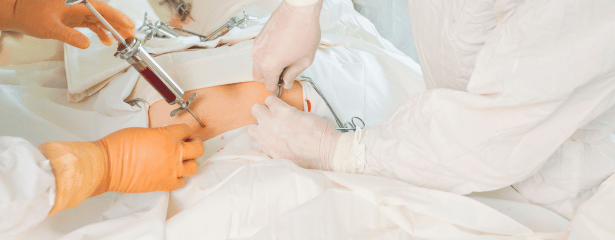 Doctors during a surgery