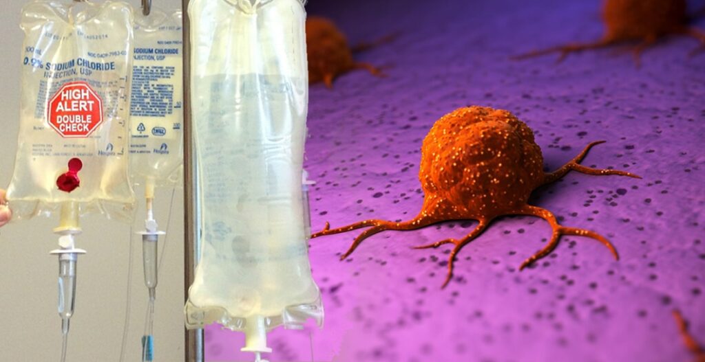 Malignant cancer cell and an IV bag