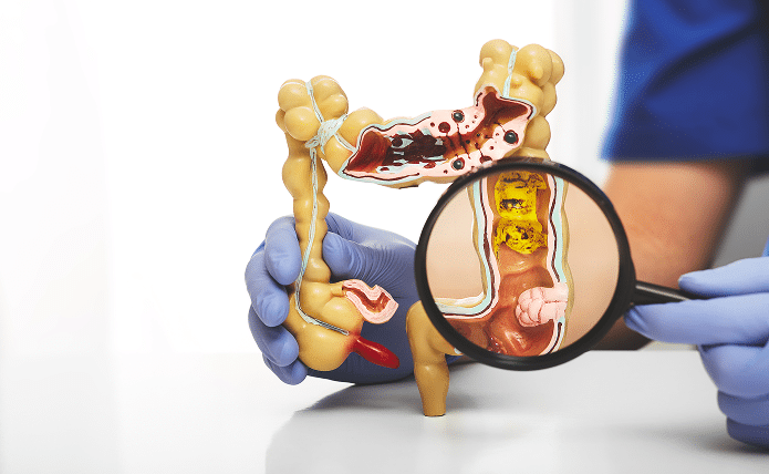 A human colon and a magnifying glass